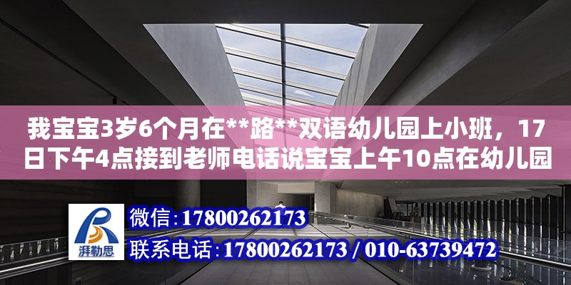 我寶寶3歲6個月在**路**雙語幼兒園上小班，17日下午4點接到老師電話說寶寶上午10點在幼兒園內玩球時摔一交，哭了，后老師檢查了下沒有什么破皮紅腫現象，然后就到下午2點多寶貝起床后老師發現寶貝在左胳膊不怎么愿意動，就立刻帶到省立醫院經檢查是左邊鎖骨骨折，叫我們立刻到醫院去下，我們趕到時寶貝已經的安適了石膏，現在寶貝沒有辦法上學我想問這個責任誰負，負多少（小區內幼兒園的物業費收費標準）